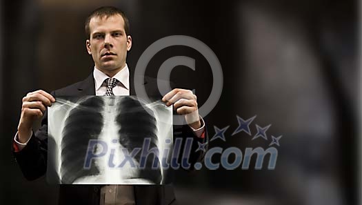 Man showing his chest x-ray