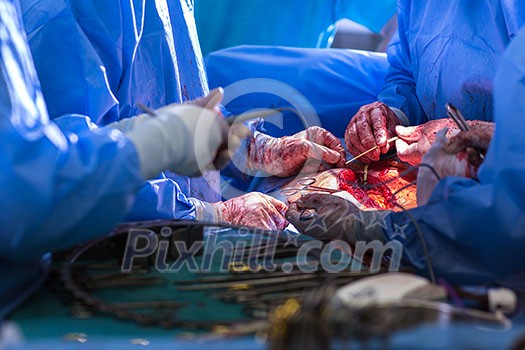 Team of surgeons performing an operation on a patient in a hospital (shallow DOF; color toned image)