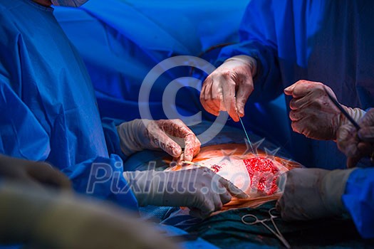Surgery in a modern hospital being performed by a team of professionals (shallow DOF, color toned image) Surgery in a modern hospital being performed by a team of professionals (shallow DOF, color toned image)