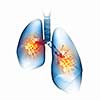 Human lungs with mechanisms. Health and medicine