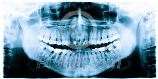 Teeth and jaw dental x-ray image Teeth and jaw dental x-ray image
