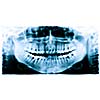 Teeth and jaw  dental  x-ray image