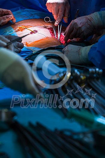 Surgery in a modern hospital being performed by a team of professionals (shallow DOF, color toned image) Surgery in a modern hospital being performed by a team of professionals (shallow DOF, color toned image)