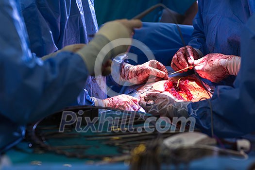 Team of surgeons performing an operation on a patient in a hospital (shallow DOF; color toned image) Team of surgeons performing an operation on a patient in a hospital (shallow DOF; color toned image)
