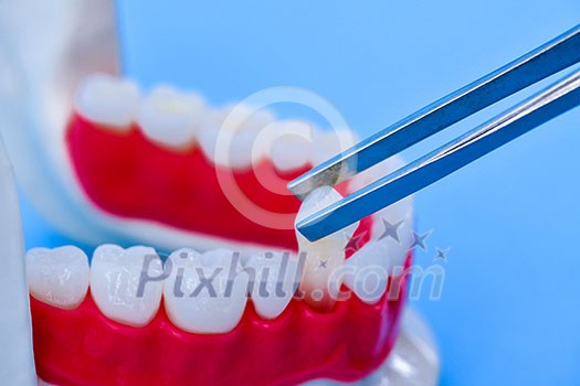 tweezers pulling tooth from the lower jaw anatomy model medical illustration isolated on blue background. Healthy teeth, dental care and orthodontic concept tweezers pulling tooth from the lower jaw anatomy model medical illustration isolated on blue background. Healthy teeth, dental care and orthodontic concept