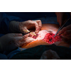 Surgery in a modern hospital being performed by a team of professionals (shallow DOF, color toned image)