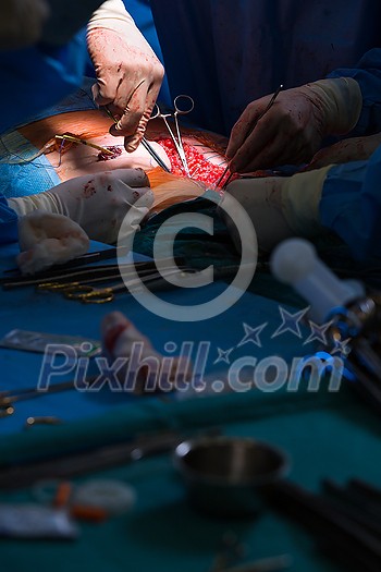 Surgery in a modern hospital being performed by a team of professionals (shallow DOF, color toned image)