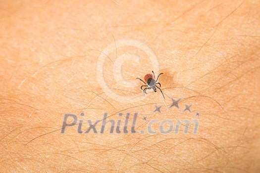 Tick - parasitic arachnid blood-sucking carrier of various diseases Tick - parasitic arachnid blood-sucking carrier of various diseases