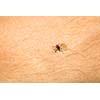 Tick - parasitic arachnid blood-sucking carrier of various diseases