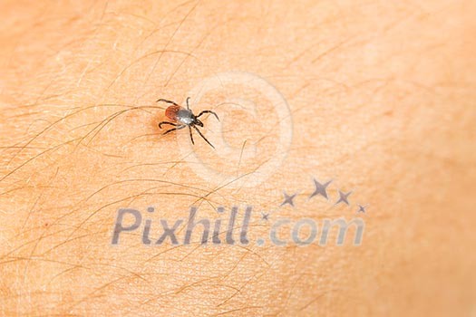 Tick - parasitic arachnid blood-sucking carrier of various diseases Tick - parasitic arachnid blood-sucking carrier of various diseases