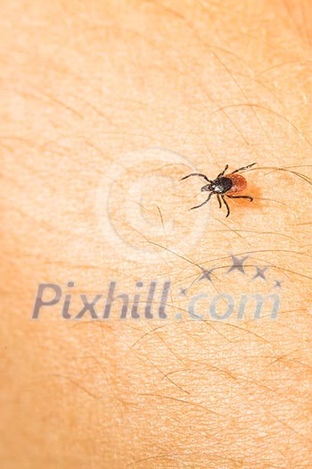 Tick - parasitic arachnid blood-sucking carrier of various diseases Tick - parasitic arachnid blood-sucking carrier of various diseases