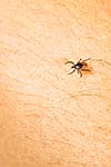 Tick - parasitic arachnid blood-sucking carrier of various diseases