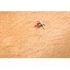 Tick - parasitic arachnid blood-sucking carrier of various diseases