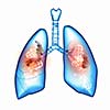 Human lungs with mechanisms. Health and medicine