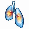 Human lungs with mechanisms. Health and medicine