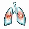 Human lungs with mechanisms. Health and medicine