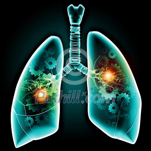 Human lungs with mechanisms. Health and medicine Human lungs with mechanisms. Health and medicine