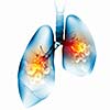 Human lungs with mechanisms. Health and medicine