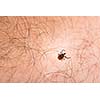 Tick - parasitic arachnid blood-sucking carrier of various diseases