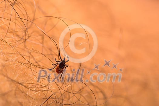 Tick - parasitic arachnid blood-sucking carrier of various diseases Tick - parasitic arachnid blood-sucking carrier of various diseases