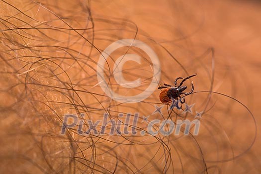 Tick - parasitic arachnid blood-sucking carrier of various diseases Tick - parasitic arachnid blood-sucking carrier of various diseases