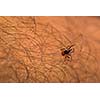 Tick - parasitic arachnid blood-sucking carrier of various diseases