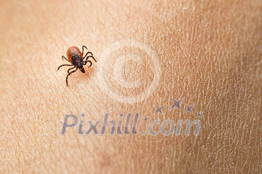 Tick - parasitic arachnid blood-sucking carrier of various diseases Tick - parasitic arachnid blood-sucking carrier of various diseases