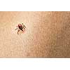 Tick - parasitic arachnid blood-sucking carrier of various diseases