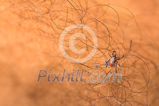 Tick - parasitic arachnid blood-sucking carrier of various diseases Tick - parasitic arachnid blood-sucking carrier of various diseases