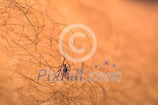 Tick - parasitic arachnid blood-sucking carrier of various diseases Tick - parasitic arachnid blood-sucking carrier of various diseases