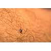 Tick - parasitic arachnid blood-sucking carrier of various diseases