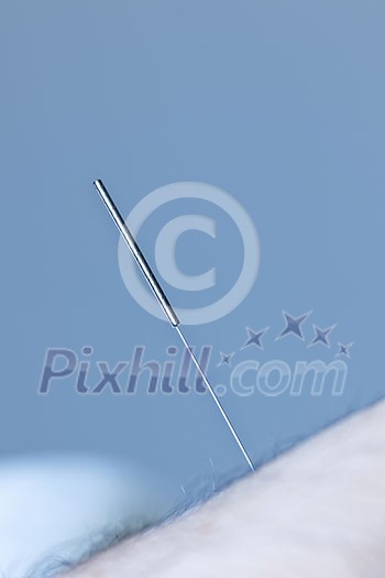 Closeup of acupuncture needle inserted in skin Closeup of acupuncture needle inserted in skin