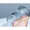 Applying cupping therapy in traditional chinese medicine on man's shoulder