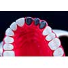 Teeth implant and crown installation process isolated on a blue background. Medically accurate 3D illustration