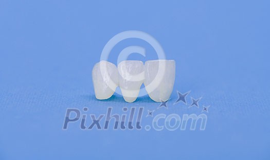 Metal free ceramic dental crowns isolated on a blue background Metal free ceramic dental crowns isolated on a blue background